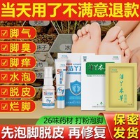 润芷堂脚气脚痒【一次搞定】脚气泡脚脚臭专用止痒脱皮水泡烂脚丫喷剂