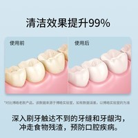 博皓(prooral)电动冲牙器正畸呵护便携洗牙器冲洗器水牙线牙齿冲洗器洁牙器牙齿清洁器超声微气泡水流口腔清洗器 纯白色