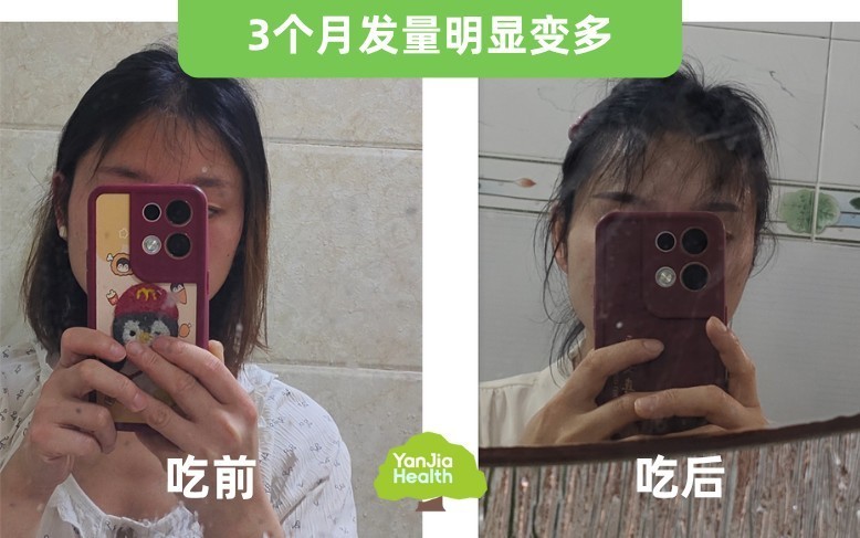 ѡƽ̨ѡƷѡ Brillowel ƬЧĺ