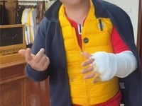 周黑鸭创始人周富裕被卡式炉扎伤险些毁容:仍直播提醒大家