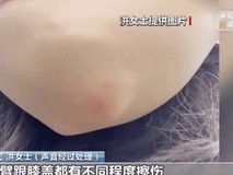 共享单车频现自动锁车事故 安全隐患与责任归属引争议