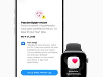 苹果发布watchOS 26更新:旧款Apple Watch新增高血压警报功能