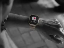 苹果推出watchOS 26更新,旧款手表也能用上高血压预警功能