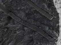 印度科研团队研发纳米机器人CalBot,或彻底解决牙齿敏感难题