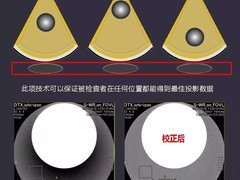 佳能肺部CT影像 快速排查新冠病毒肺炎