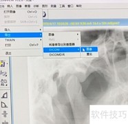 Soredex导出Dicom文件指南
