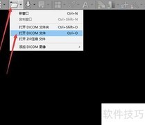 如何打开DCM文件