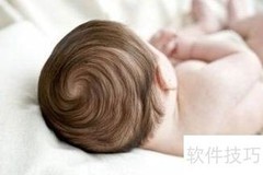 宝宝枕秃怎么办？这样护理有效