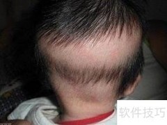 宝宝枕秃怎么办？这样护理有效