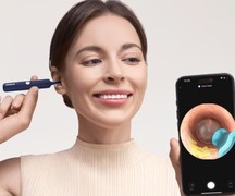 宝妈、科技控都在抢！可视化掏耳勺凭啥火成爆款？