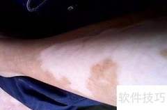 白点疯病因解析