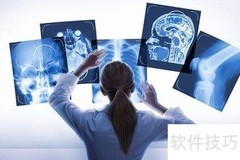 哪些人需定期做CT？一文读懂