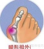护理身体的几个小妙招