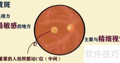 眼底检查方法详解