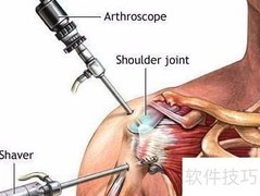 关节镜清洗维护指南