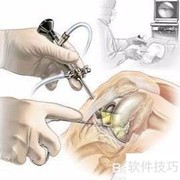 关节镜清洗维护指南