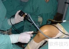 膝关节镜手术预防指南
