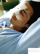 美白针注意事项全解析