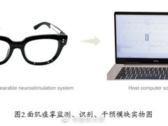 清华研发智能眼镜实现面肌痉挛无创治疗
