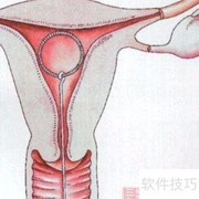 常用避孕方法一览