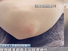 共享单车频现自动锁车事故 安全隐患与责任归属引争议