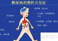 糖尿病饮食调理全攻略