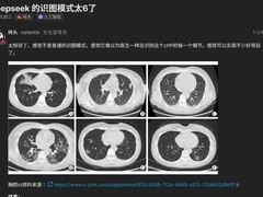 DeepSeek V4发布5天即推多模态灰度测试，强化医疗辅助与图像理解能力