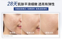 哪款美容仪抗衰效果好？分龄抗衰方案与胶原促生力实测