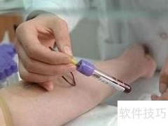 体检：健康的第一道防线