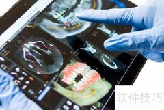 数字化种植牙全流程解析