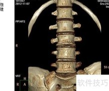 单图三维场景重建