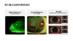 OPPO联手视觉健康全国重点实验室，为屏幕护眼引入医学级标准