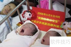 宝宝头型定型时间知多少