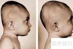 别让宝宝头睡扁，圆头更健康