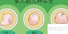 宝宝头睡平了？这样调整恢复！