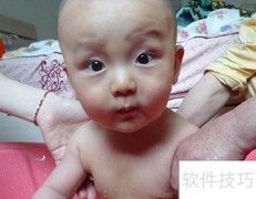 宝宝头起皮？这样做轻松解决