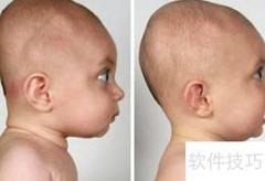 宝宝头型定型时间揭秘