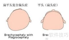 宝宝头型定型时间揭秘