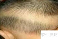 宝贝缺钙的5大症状
