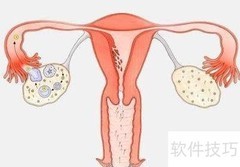 适合冻胚移植的人群有哪些