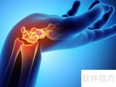 肌腱炎缓解小妙招