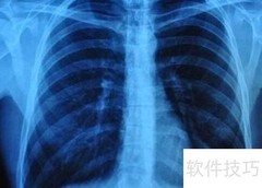 X光检查前的准备工作
