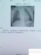 X光胸片快速解读指南