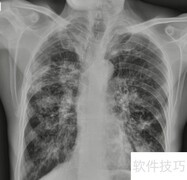 X光、B超、CT、MRI区别