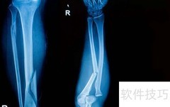 X光、B超、CT、MRI区别
