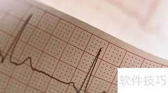 心电图检查的作用揭秘