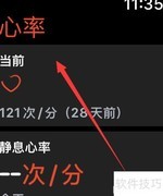 苹果手表可测心电图