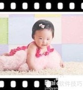 孕期心电图检查注意事项