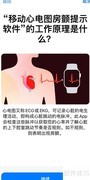 Apple Watch心电图使用指南