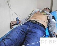 心电图检查的关键意义